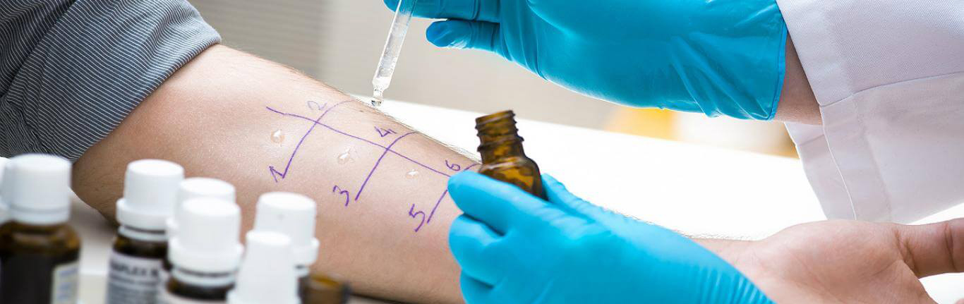 Аллерголог