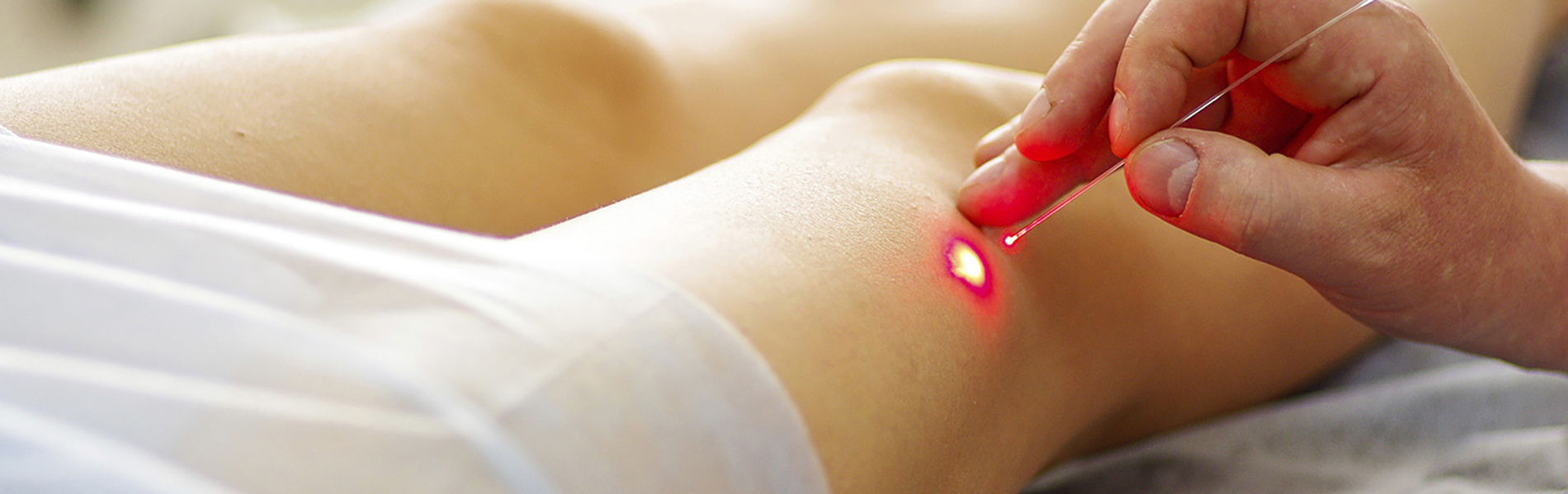 Лазерная терапия